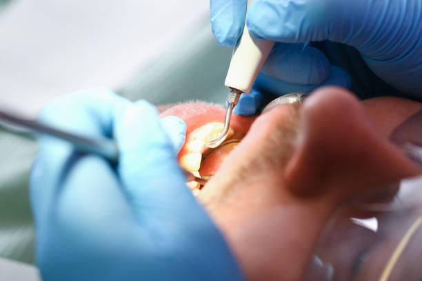Professional Emergency Dental Service in AL